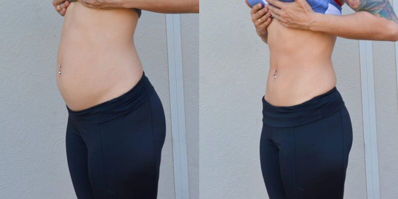 Before and after training